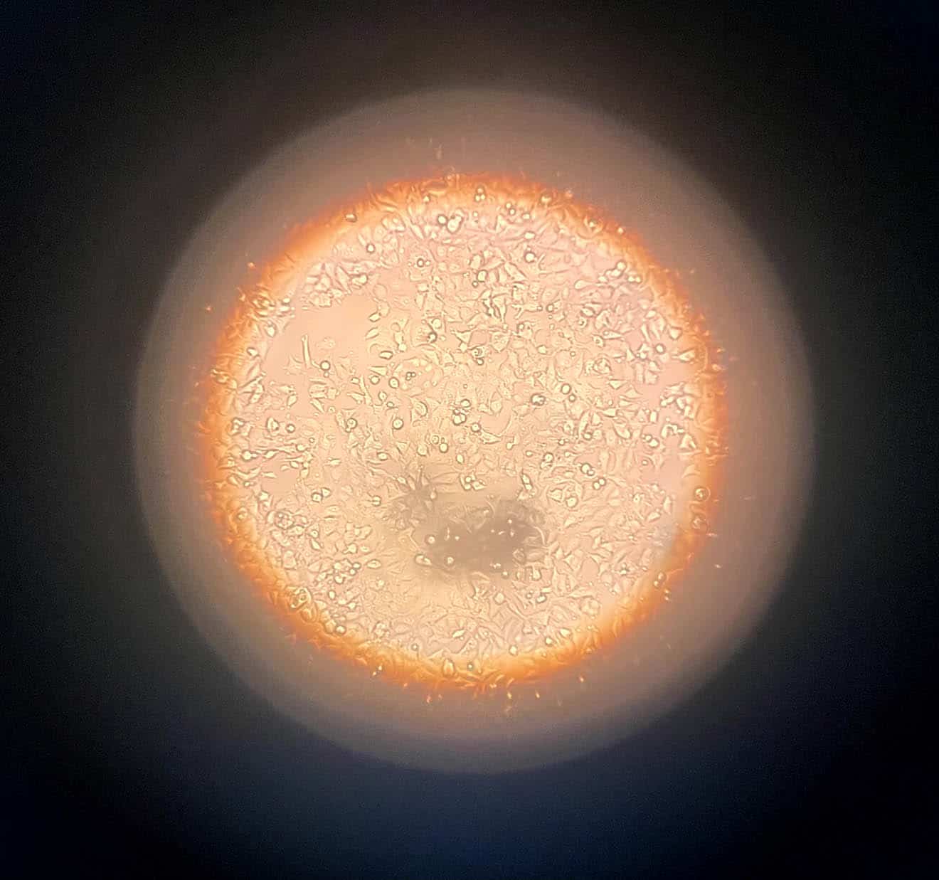 Cells under a microscope.